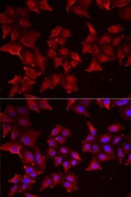 Immunocytochemistry/ Immunofluorescence: PCBD1 Antibody - BSA Free [NBP2-93878]