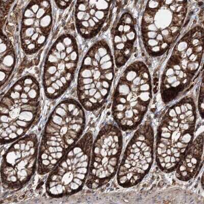 Immunohistochemistry-Paraffin: PCBD2 Antibody [NBP1-85281]