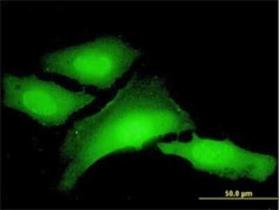Immunocytochemistry/ Immunofluorescence: PCBP1 Antibody (1G2) [H00005093-M01]