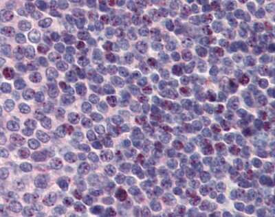 Immunohistochemistry: PCBP1 Antibody [NBP1-80455]