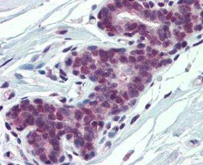 Immunohistochemistry-Paraffin: PCBP1 Antibody [NBP1-80455]