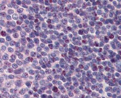 Immunohistochemistry-Paraffin: PCBP1 Antibody [NBP1-80455]