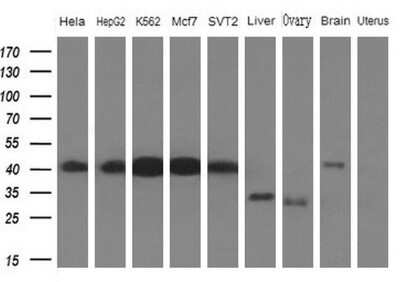 Western Blot: PCBP1 Antibody (OTI3D12)Azide and BSA Free [NBP2-73268]