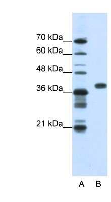 Western Blot: PCBP1 Antibody [NBP1-80454]