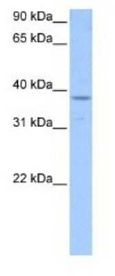 Western Blot: PCBP1 Antibody [NBP1-80455]