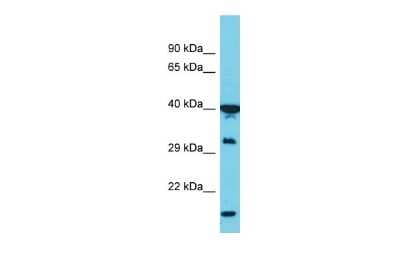 Western Blot: PCBP1 Antibody [NBP1-80455]