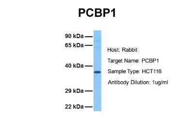 Western Blot: PCBP1 Antibody [NBP1-80455]