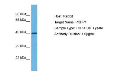 Western Blot: PCBP1 Antibody [NBP1-80455]
