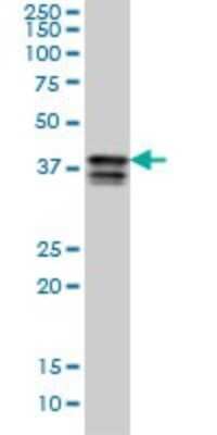 Western Blot: PCBP2 Antibody (5F12) [H00005094-M07]