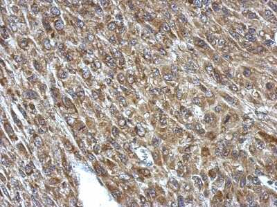 Immunohistochemistry-Paraffin: PCCA Antibody [NBP2-19717]
