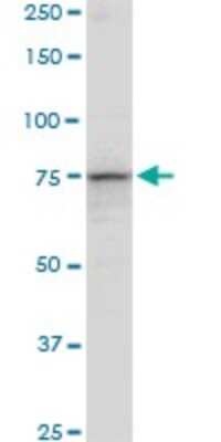 Western Blot: PCCA Antibody [H00005095-B01P]