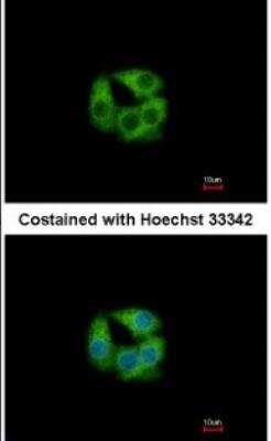Immunocytochemistry/ Immunofluorescence: PCCB Antibody [NBP1-31464]