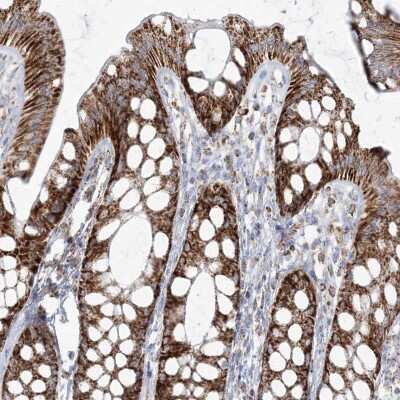 Immunohistochemistry-Paraffin: PCCB Antibody [NBP1-85886]
