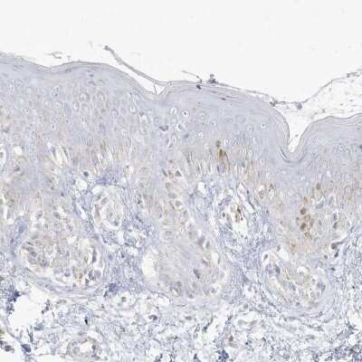 Immunohistochemistry-Paraffin: PCCB Antibody [NBP1-85886]