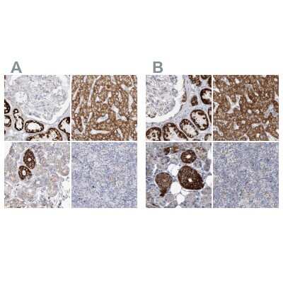 Immunohistochemistry-Paraffin: PCCB Antibody [NBP1-85886]