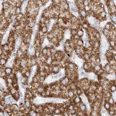 Immunohistochemistry-Paraffin: PCCB Antibody [NBP1-85886]