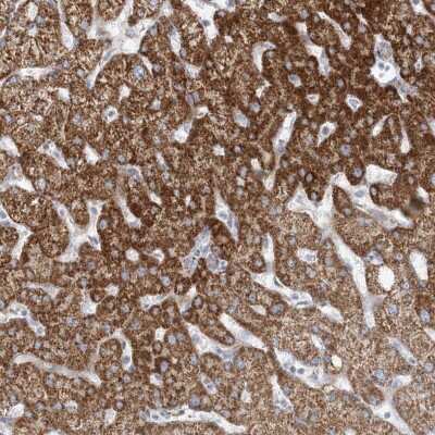 Immunohistochemistry-Paraffin: PCCB Antibody [NBP1-85887]