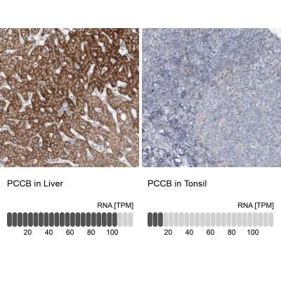 Immunohistochemistry-Paraffin: PCCB Antibody [NBP1-85887]
