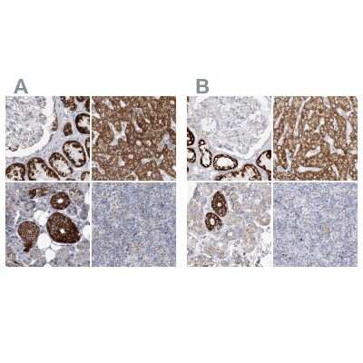 Immunohistochemistry-Paraffin: PCCB Antibody [NBP1-85887]