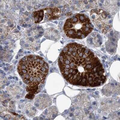 Immunohistochemistry-Paraffin: PCCB Antibody [NBP1-85887]