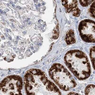 Immunohistochemistry-Paraffin: PCCB Antibody [NBP1-85887]