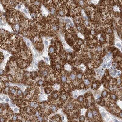 Immunohistochemistry-Paraffin: PCCB Antibody [NBP1-85887]