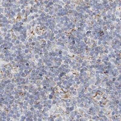 Immunohistochemistry-Paraffin: PCCB Antibody [NBP1-85887]