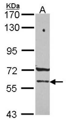 Western Blot: PCCB Antibody [NBP2-19718]