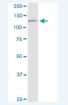Western Blot: PCDH11 Antibody (7B4) [H00027328-M05-50ug]