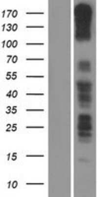 Western Blot: PCDH11X Overexpression Lysate [NBP2-05952]