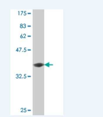 Western Blot: PCDH11 Antibody (1G5) [H00083259-M06]