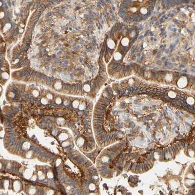 Immunohistochemistry-Paraffin: PCDH7 Antibody [NBP1-88610]