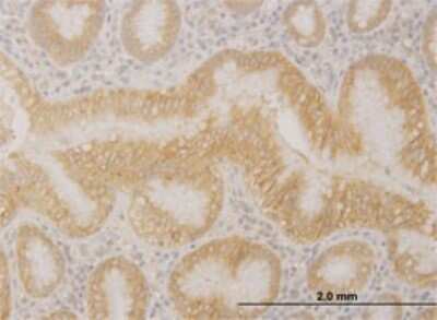 Immunohistochemistry-Paraffin: PCDHA10 Antibody (1F6) [H00056139-M01]
