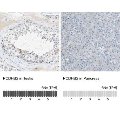 Immunohistochemistry-Paraffin: PCDHB2 Antibody [NBP2-30922]