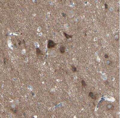 Immunohistochemistry-Paraffin: PCDHGA2 Antibody [NBP2-54658]