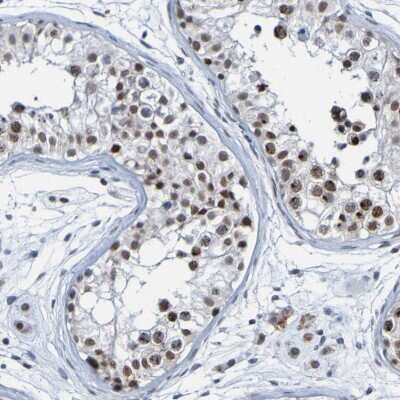 Immunohistochemistry-Paraffin: PCGF1 Antibody [NBP1-82767]