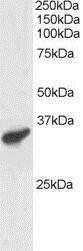 Western Blot: PCGF3 Antibody [NB100-1171]