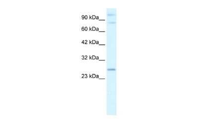 Western Blot: PCGF3 Antibody [NBP2-88019]