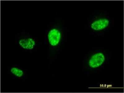 Immunocytochemistry/ Immunofluorescence: PCGF5 Antibody (3C10) [H00084333-M01]