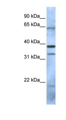 Western Blot: PCGF5 Antibody [NBP1-55283]