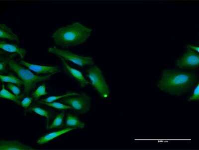 Immunocytochemistry/ Immunofluorescence: PCID2 Antibody [H00055795-D01P]