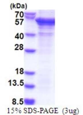 SDS-PAGE: Recombinant Human PCID2 His Protein [NBP2-51816]