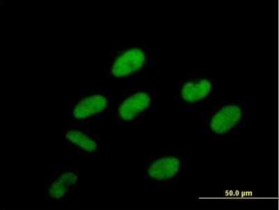 Immunocytochemistry/ Immunofluorescence: PCIF1 Antibody [H00063935-B01P]