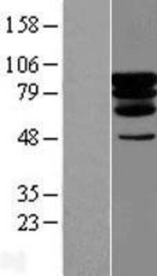 Western Blot: PCIF1 Overexpression Lysate [NBL1-14178]