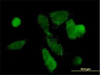 Immunocytochemistry/ Immunofluorescence: PCK1 Antibody (3E4) [H00005105-M01]