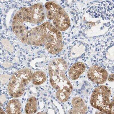 Immunohistochemistry-Paraffin: PCK1 Antibody [NBP1-80927]