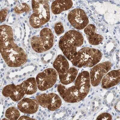 Immunohistochemistry-Paraffin: PCK1 Antibody [NBP1-80928]