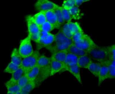 Immunocytochemistry/ Immunofluorescence: PCK1 Antibody (JU84-39) [NBP2-75609]