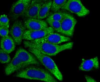 Immunocytochemistry/ Immunofluorescence: PCK1 Antibody (JU84-39) [NBP2-75609]