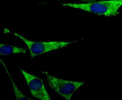 Immunocytochemistry/ Immunofluorescence: PCK1 Antibody (JU84-39) [NBP2-75609]